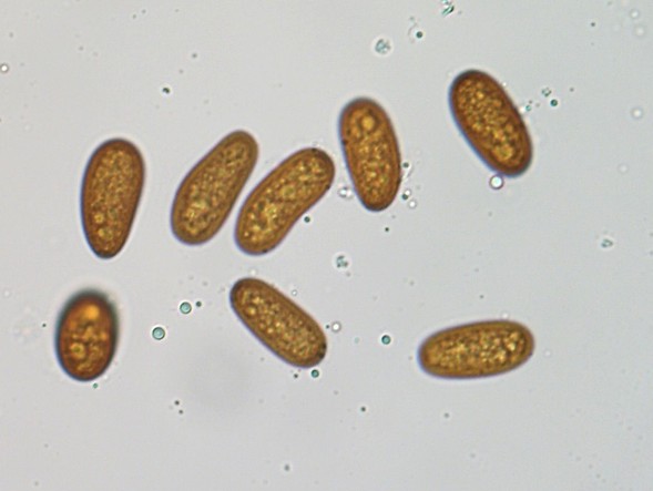 Mikroskopische Aufnahme von Konidiosporen von Diplodia seriata