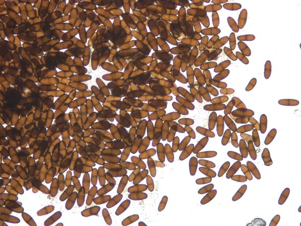 Mikroskopische Aufnahme von Diplodia Konidiosporen