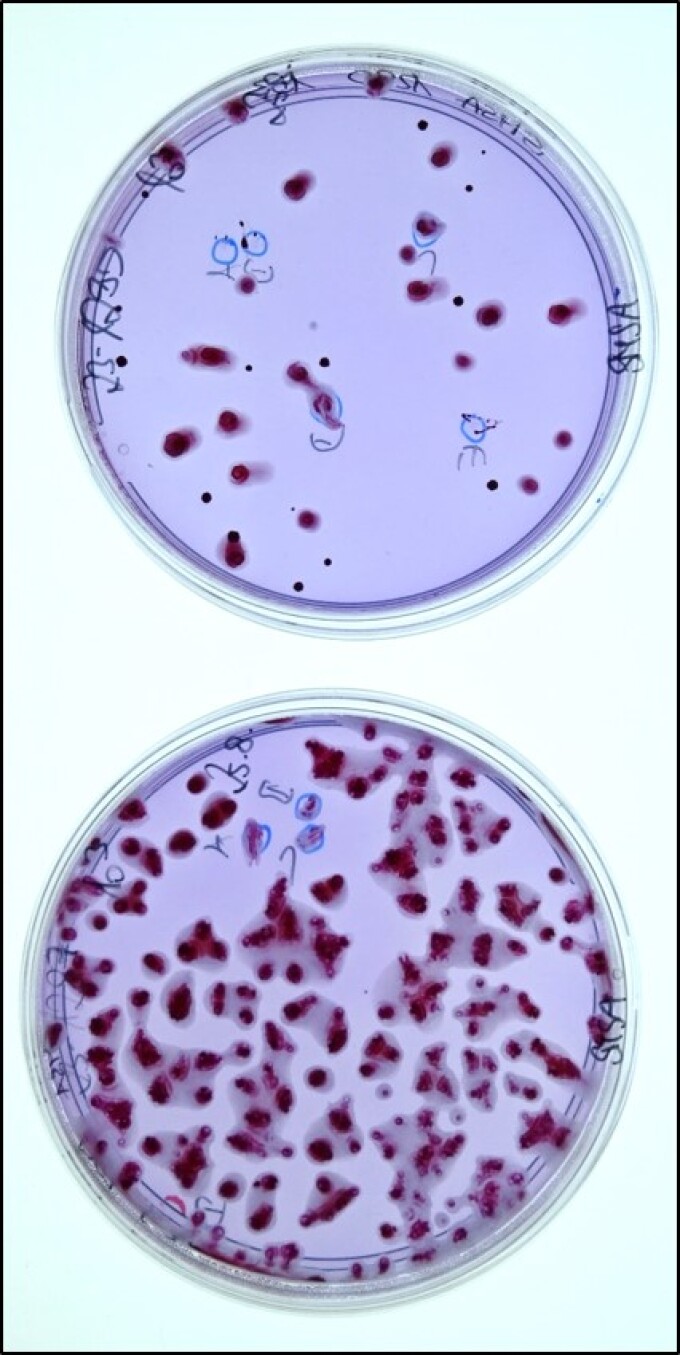 Kolonien mit typischer Morphologie von Ralstonia pseudosolanacearum